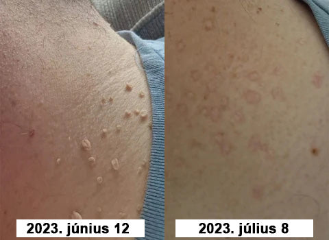 đAQAâą TagRecede mĂ©hmĂ©reg kezelĆ spray