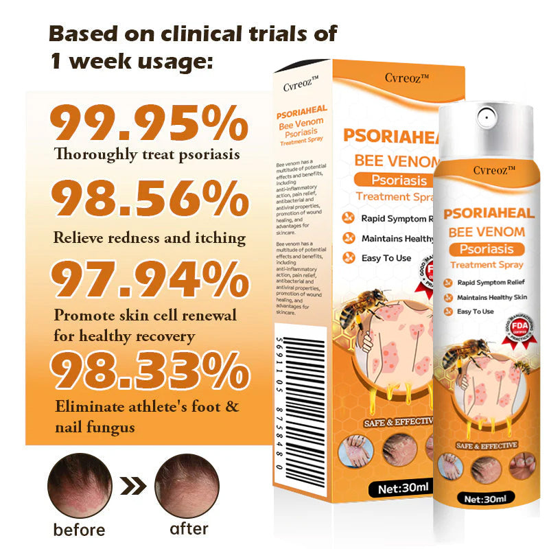 đŸCvreozâą PsoriaHeal Bee Venom Psoriasis Treatment Spray(Suitable for all skin conditions)