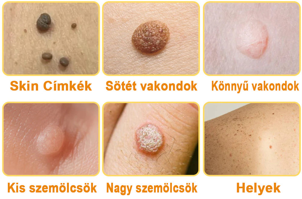đAQAâą TagRecede mĂ©hmĂ©reg kezelĆ spray