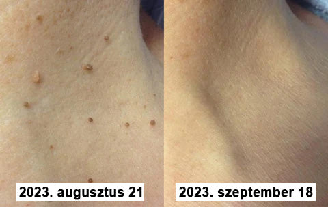 đAQAâą TagRecede mĂ©hmĂ©reg kezelĆ spray