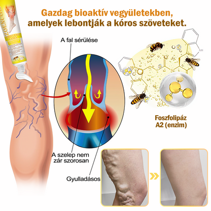 Zoencgz™👨‍⚕️✨Hivatalos márkabolt✨Méhméreg Arthritis & Varicose Vein Treatment Cream (NIPN & HSP Recommends)