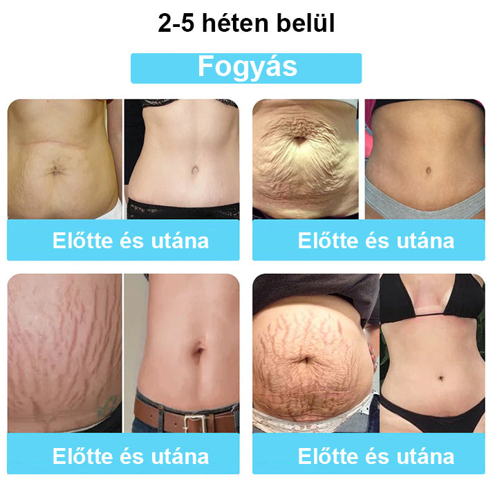 🔥Ingyenes az első 500 vásárlónak🔥Csak ma❄️CUSIJAS™👑Nano-Ion zsírégető Detox Icy Silk Shapewear🔥Utolsó 20 percben🔥80% kedvezmény