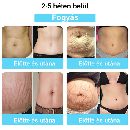 🔥Ingyenes az első 500 vásárlónak🔥Csak ma❄️CUSIJAS™👑Nano-Ion zsírégető Detox Icy Silk Shapewear🔥Utolsó 20 percben🔥80% kedvezmény