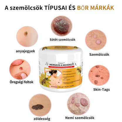 🌟[✨Utolsó nap 50% kedvezménnyel✨]🐝🐝🐝Lenaro™ méhméreg vakond- és szemölcskezelő krém(👨‍⚕AAD AJÁNLJA)