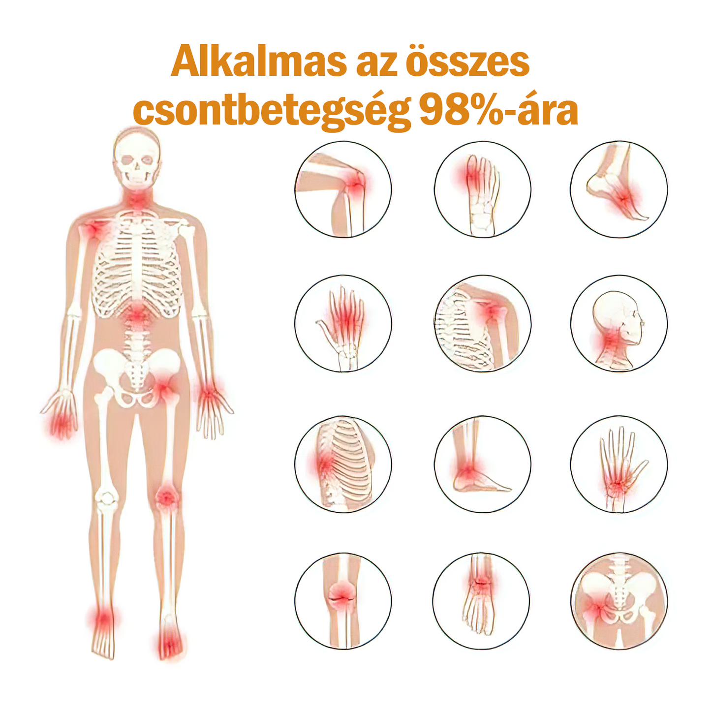 Zoencgz™👨‍⚕️✨Hivatalos márkabolt✨Méhméreg Arthritis & Varicose Vein Treatment Cream (NIPN & HSP Recommends)