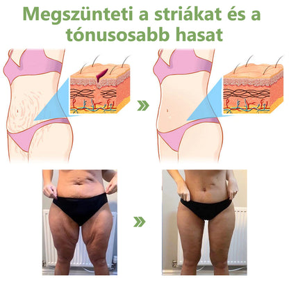 Awzlove™ Luxus Collagen Feszesítő Krém (🔥80% kedvezmény korlátozott ideig!)🥑