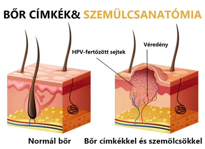 🌟[✨Utolsó nap 50% kedvezménnyel✨]🐝🐝🐝Lenaro™ méhméreg vakond- és szemölcskezelő krém(👨‍⚕AAD AJÁNLJA)