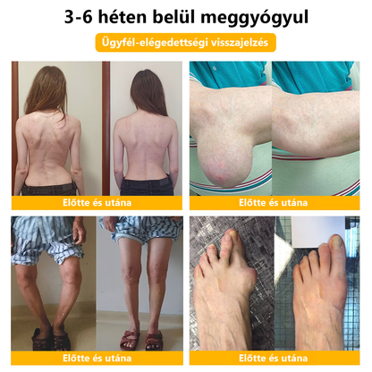 ArthroFree™ méhméreg fájdalomcsillapító és csontgyógyító krém (🐝Kifejezetten idősek számára készült, az OGYÉI ajánlja)