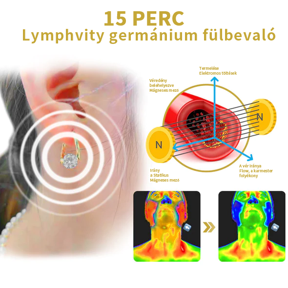 (🔥UTOLSÓ NAP AKCIÓ -60% KEDVEZMÉNY)Histone Lymphvity MagneTerápia Germánium Fülbevaló