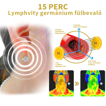 (🔥UTOLSÓ NAP AKCIÓ -60% KEDVEZMÉNY)Histone Lymphvity MagneTerápia Germánium Fülbevaló