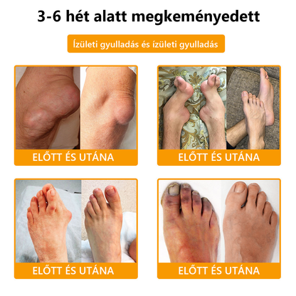 ArthroFree™ méhméreg fájdalomcsillapító és csontgyógyító krém (🐝Kifejezetten idősek számára készült, az OGYÉI ajánlja)