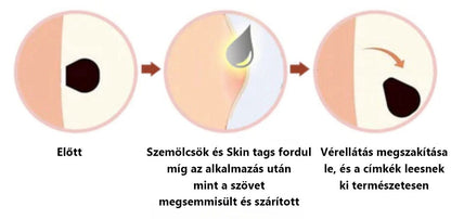 🌟[✨Utolsó nap 50% kedvezménnyel✨]🐝🐝🐝Lenaro™ méhméreg vakond- és szemölcskezelő krém(👨‍⚕AAD AJÁNLJA)