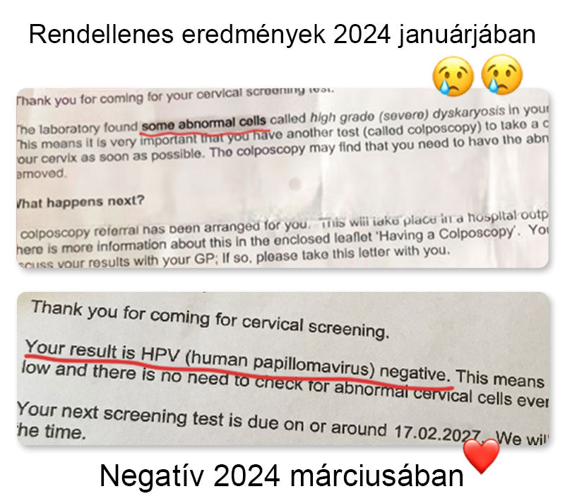 {𝐈𝐧𝐠𝐲𝐞𝐧𝐞𝐬 𝐚𝐳 𝐞𝐥𝐬ő 𝟓𝟎𝟎 𝐯á𝐬á𝐫𝐥ó𝐧𝐤𝐧𝐚𝐤} 𝐂𝐬𝐚𝐤 𝐌𝐀 𝐂𝐯𝐫𝐞𝐨𝐳® 𝐌é𝐡𝐦é𝐫𝐠𝐞𝐳𝐞𝐭𝐭 𝐍𝐌𝐍 𝐍𝐚𝐭𝐮𝐫𝐚𝐥 𝐑𝐞𝐩𝐚𝐢𝐫 𝐕𝐚𝐠𝐢𝐧á𝐥𝐢𝐬 𝐊𝐚𝐩𝐬𝐳𝐮𝐥á𝐤 [𝐌𝐢𝐧𝐝𝐞𝐧 𝐡ü𝐯𝐞𝐥𝐲𝐢 𝐞𝐬 𝐡𝐨𝐫𝐦𝐨𝐧á𝐥𝐢𝐬 𝐩𝐫𝐨𝐛𝐥é𝐦á𝐤𝐫𝐚]💏