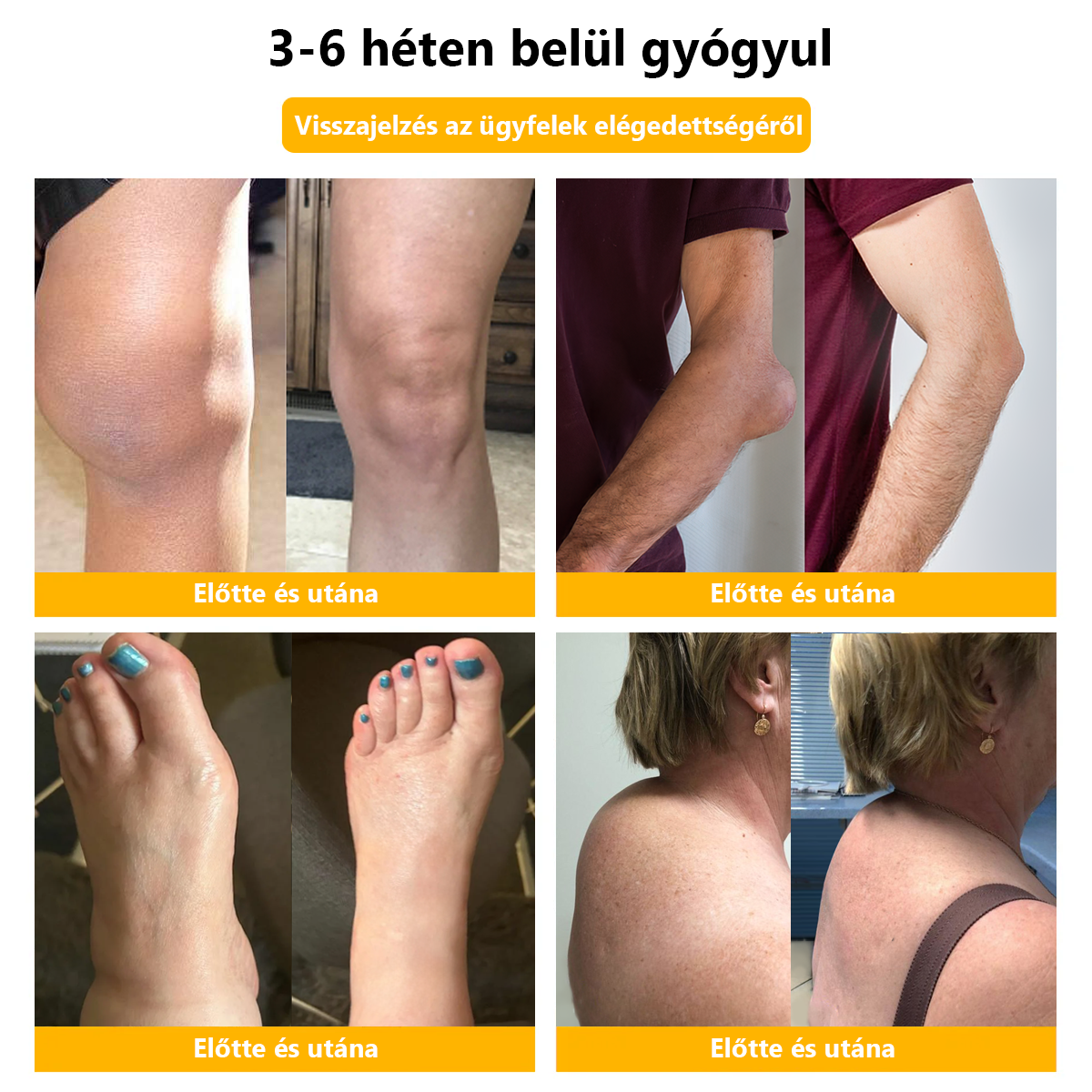 ✅Hivatalos üzlet: 𝐋𝐎𝐕𝐈𝐋𝐃𝐒™ Méhméreg fájdalomcsillapító csontgyógyító krém 👨‍⚕️Magyar Csontgyógyászok Egyesülete (EMA) jóváhagyásával (csökkenti az ízületi duzzanatot, fájdalmat, ízületi merevséget, fáradtságot, bőrpírt)