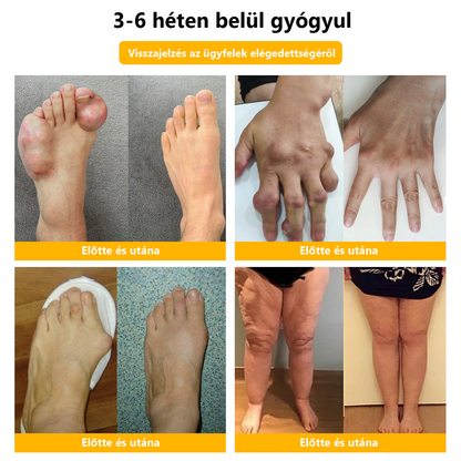 ✅Hivatalos üzlet: 𝐋𝐎𝐕𝐈𝐋𝐃𝐒™ Méhméreg fájdalomcsillapító csontgyógyító krém 👨‍⚕️Magyar Csontgyógyászok Egyesülete (EMA) jóváhagyásával (csökkenti az ízületi duzzanatot, fájdalmat, ízületi merevséget, fáradtságot, bőrpírt)