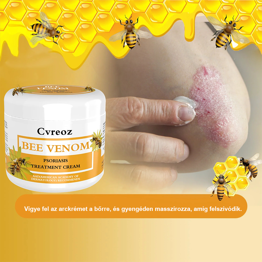 🌟Cvreoz méhméreg pikkelysömör kezelésére krém (👨‍⚕AAD AJÁNLJA)🐝🐝