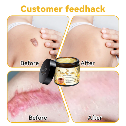 𝑇𝑢𝑟𝑜𝑛𝑢™ Bee Venom Skin Treatment Cream（EDQM 𝑅𝑒𝑐𝑜𝑚𝑚𝑒𝑛𝑑𝑒𝑑）