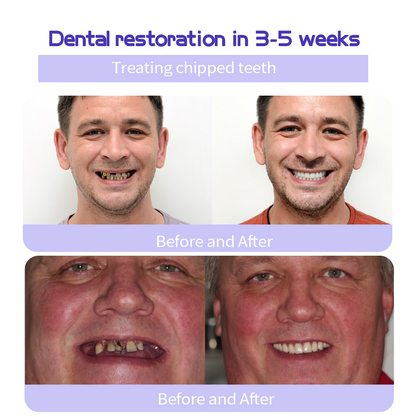 Cvreoz™ (ADA recommended)Teeth Restoration Mineral Powder(😁𝐋𝐢𝐦𝐢𝐭𝐞𝐝 𝐭𝐢𝐦𝐞 𝐝𝐢𝐬𝐜𝐨𝐮𝐧𝐭 𝐋𝐚𝐬𝐭 𝟑𝟎 𝐦𝐢𝐧𝐮𝐭𝐞𝐬😁) ☀️