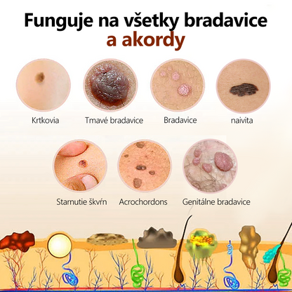 🌈[✨Posledný deň 50% zľava✨]🐝🐝🐝 Krém na ošetrenie krtkov a bradavíc s včelím jedom Lenaro™ (👨‍⚕EDQM ODPORÚČA)