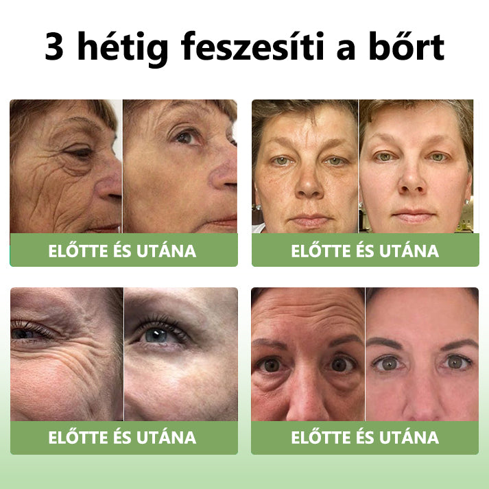 Awzlove™ Luxus Collagen Feszesítő Krém (🔥80% kedvezmény korlátozott ideig!)🥑