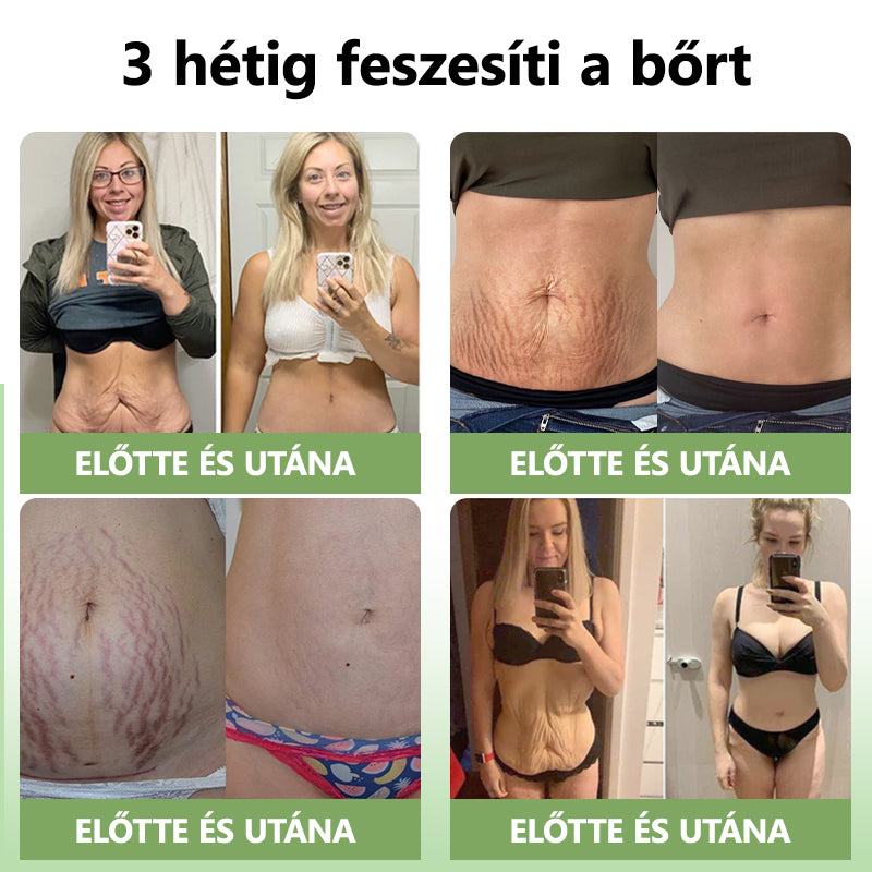 Awzlove™ Luxus Collagen Feszesítő Krém (🔥80% kedvezmény korlátozott ideig!)🥑