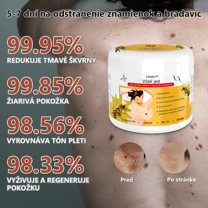 🌈[✨Posledný deň 50% zľava✨]🐝🐝🐝 Krém na ošetrenie krtkov a bradavíc s včelím jedom Lenaro™ (👨‍⚕EDQM ODPORÚČA)