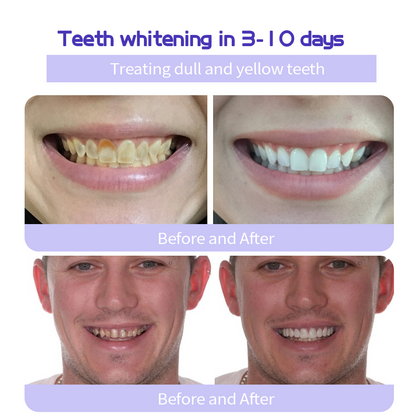 Cvreoz™ (ADA recommended)Teeth Restoration Mineral Powder(😁𝐋𝐢𝐦𝐢𝐭𝐞𝐝 𝐭𝐢𝐦𝐞 𝐝𝐢𝐬𝐜𝐨𝐮𝐧𝐭 𝐋𝐚𝐬𝐭 𝟑𝟎 𝐦𝐢𝐧𝐮𝐭𝐞𝐬😁) ☀️