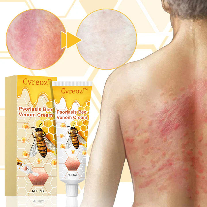 👾Cvreoz™ Psoriasis Bee Venom Cream