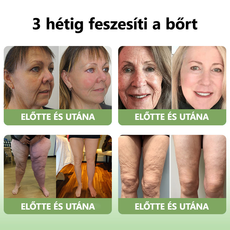 Awzlove™ Luxus Collagen Feszesítő Krém (🔥80% kedvezmény korlátozott ideig!)🥑