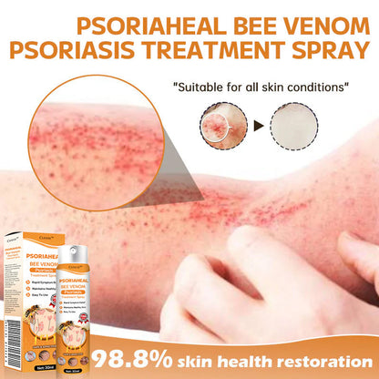 👾Cvreoz™ PsoriaHeal Bee Venom Psoriasis Treatment Spray(Suitable for all skin conditions)