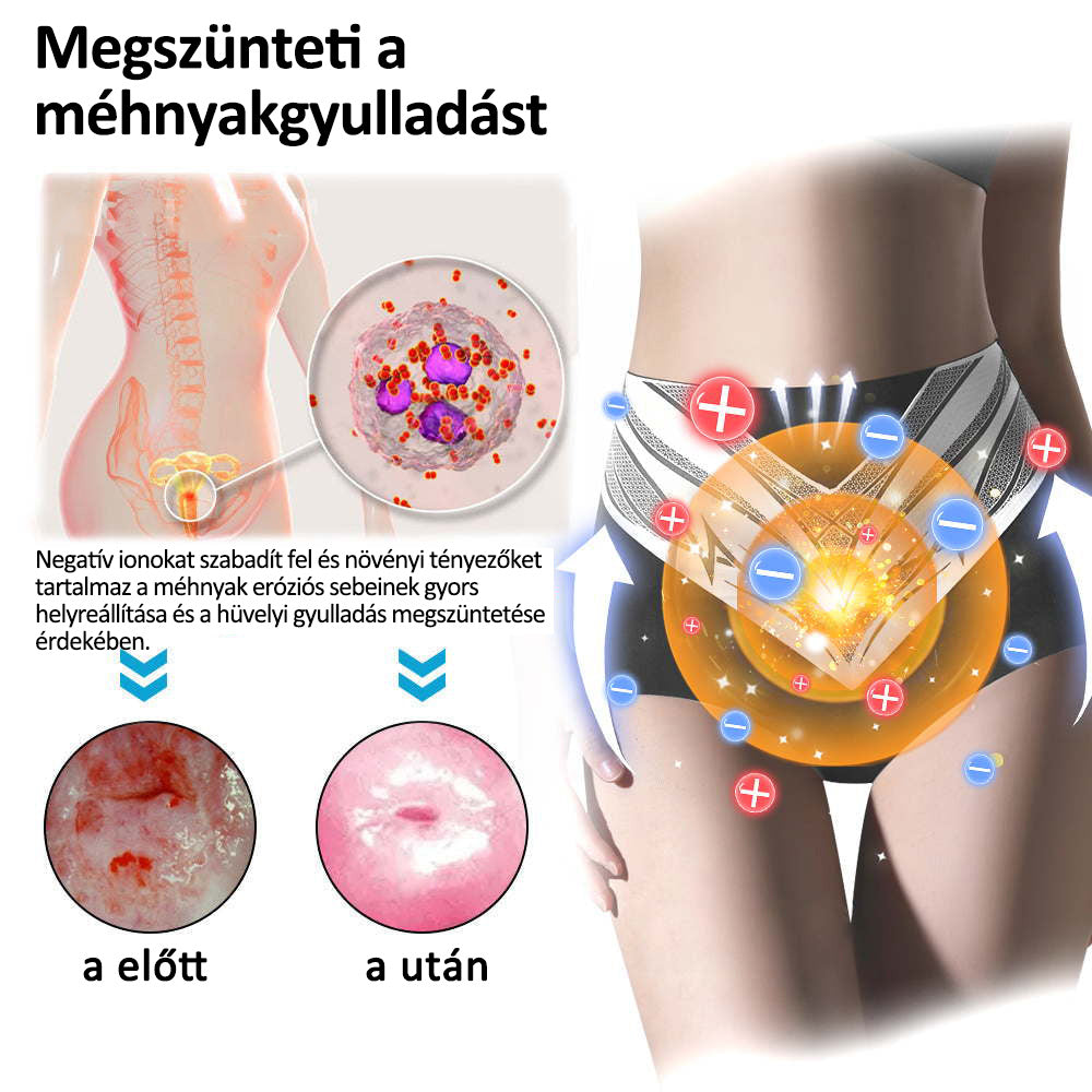 EXPECTSKY™ orvosi minőségű titánszálas önmelegedő, állandó hőmérsékletű, turmalin formáló rövidnadrág