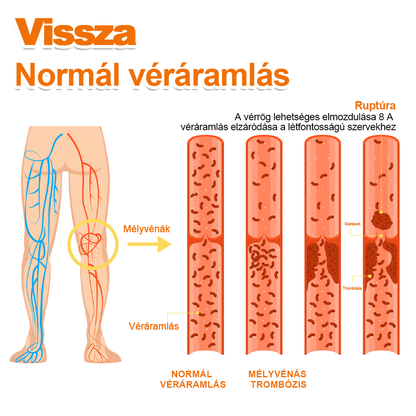 Zoencgz™👨‍⚕️✨Hivatalos márkabolt✨Méhméreg Arthritis & Varicose Vein Treatment Cream (NIPN & HSP Recommends)