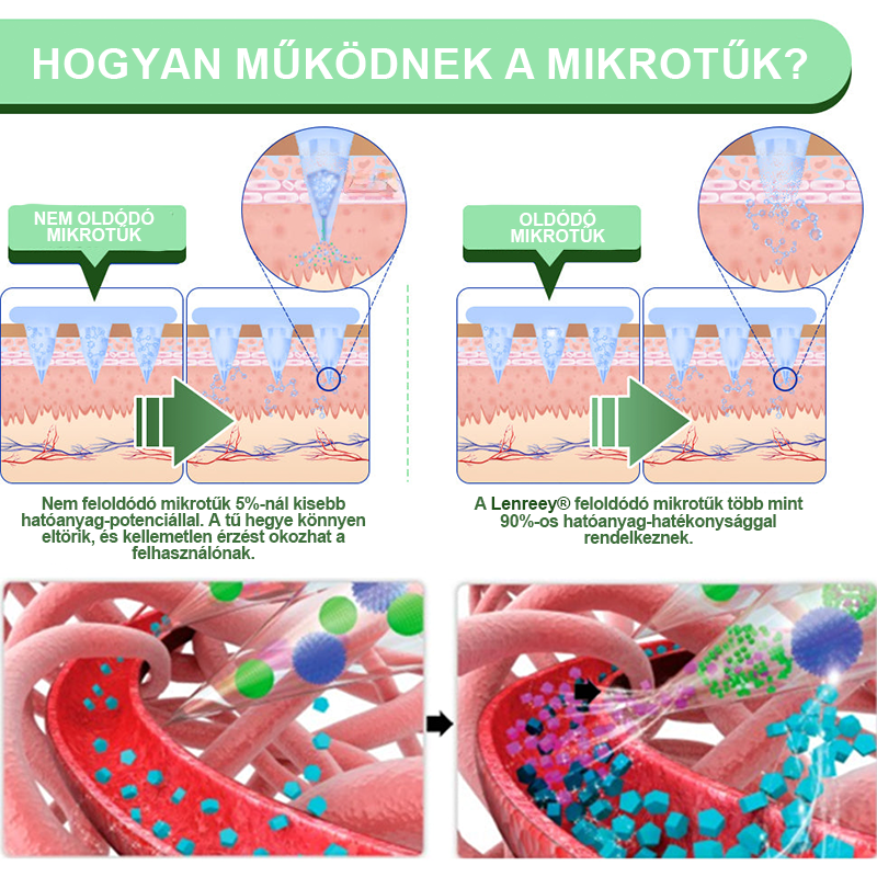 Lenreey® GIP+GLP-1 nano mikrotű tapasz👩‍⚕️ (Fájdalommentes, hosszan tartó, kezeli a cukorbetegséget, az elhízást és a szív- és érrendszeri betegségeket)✅