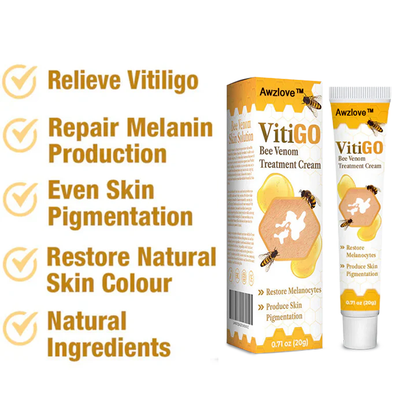 🍀Awzlove™ BeeVenom Vitiligo Treatment Cream(🎉Suitable for all ages, including the elderly and children)