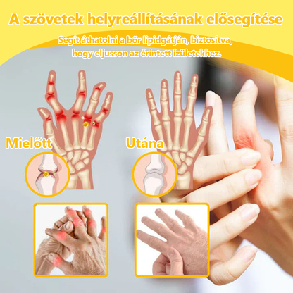 ✅Hivatalos üzlet: 𝐋𝐎𝐕𝐈𝐋𝐃𝐒™ Méhméreg fájdalomcsillapító csontgyógyító krém 👨‍⚕️Magyar Csontgyógyászok Egyesülete (EMA) jóváhagyásával (csökkenti az ízületi duzzanatot, fájdalmat, ízületi merevséget, fáradtságot, bőrpírt)